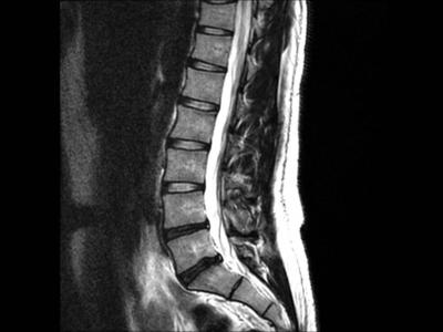 Treatments and Re-Evaluations